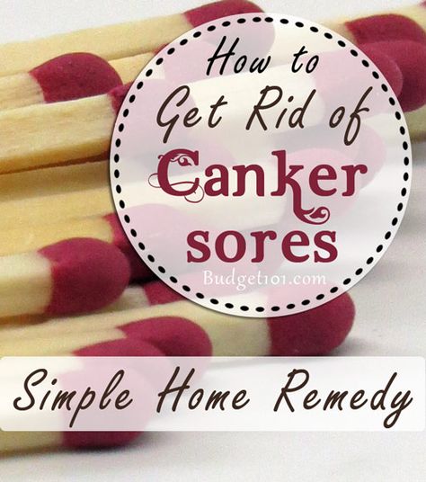 Homemade Canker Sore Remedy Canker Sore Home Remedies, Canker Sore Remedy, Snoring Remedies, Canker Sore, Homemade Remedies, Diy Health, Natural Home Remedies, Back To Nature, Health And Beauty Tips