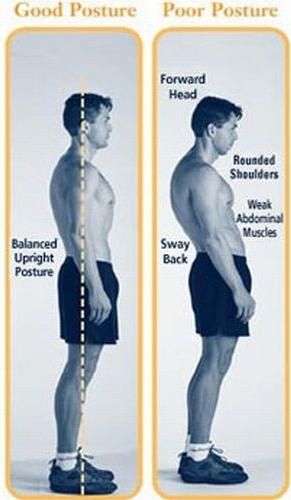 Swayback21 How To Get Tall, Posture Fix, Sway Back, Hip Problems, Posture Exercises, Perfect Posture, Bad Posture, Body Posture, Poor Posture