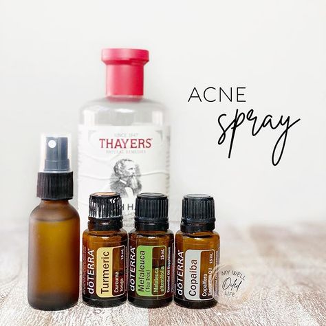 DōTERRA Oils | Kayla Monson (@mywelloiledlife) • Instagram photos and videos Natural Mom, Doterra Oils, Oil Uses, Essential Oil Uses, Doterra Essential Oils, Essential Oil Recipes, Doterra, Your Back, Tea Tree