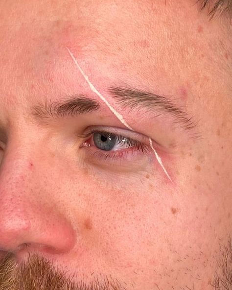 Face Scar Tattoo, White Scar Tattoo, Scar Face Tattoo Design, White Ink Tattoo Face, Eye Scar Tattoo, White Tattoo Face, Scar Face Tattoo, Red Face Tattoo, White Ink Face Tattoo