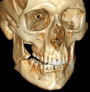 U.S. Army is Researching 3D Printing & its Potential in Facial Reconstruction Surgery Facial Reconstruction Surgery, Facial Reconstruction, Facial Bones, Australian Army, Additive Manufacturing, Reconstructive Surgery, Anatomy Study, Anatomy Reference, The Military