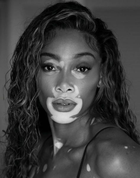 Winnie Harlow - November 30th, 2023 Vogue Netherlands, Winnie Harlow, Vogue Magazine, Fashion Poses, Up Hairstyles, Netherlands, Fashion Beauty, Vogue, Magazine