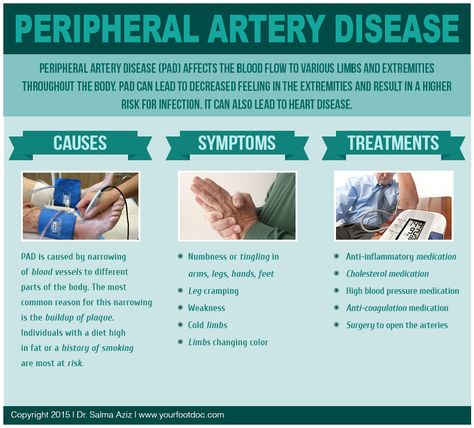 Peripheral Vascular Disorders, Peripheral Arterial Occlusive Disease, Pad Nursing, Disease Infographic, Peripheral Artery, Unclog Arteries, High Blood Pressure Medication, Legs Exercise, Nursing Study Tips