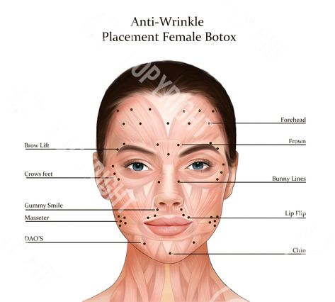 Botox Lip Flip, Botox Injection Sites, Injection Sites, Lip Flip, Botox Injection, Botox Filler, Botox Lips, Muscles Of The Face, Aesthetic Dermatology