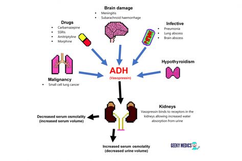 Causes of SIADH Siadh Nursing, Dka Vs Hhns Nursing, Siadh Nursing Mnemonic, Raas System Nursing Mnemonics, Digoxin Nursing Mnemonics, Nanda Nursing Diagnosis, Subarachnoid Hemorrhage, Med Surg, Nursing School Survival