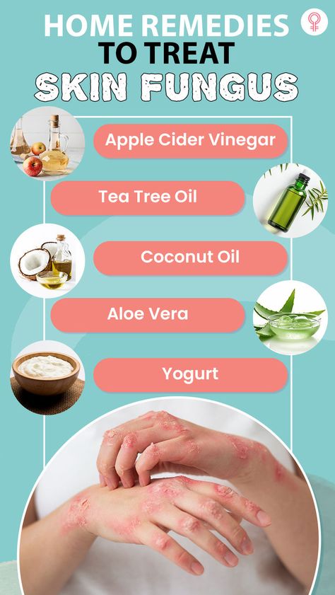 Home Remedies That Actually Help Treat Skin Fungus: These homemade treatments have been used for generations and use the power of nature to fight off the fungus. In this article, we will explore some easy and effective solutions to treat skin fungus. Read on! Skin Rash Remedies, Aloe Vera Image, Apple Cider Vinegar Tea, Skin Fungus, Oil Image, Fungal Infection Skin, Beauty Diet, Bread Storage, Power Of Nature