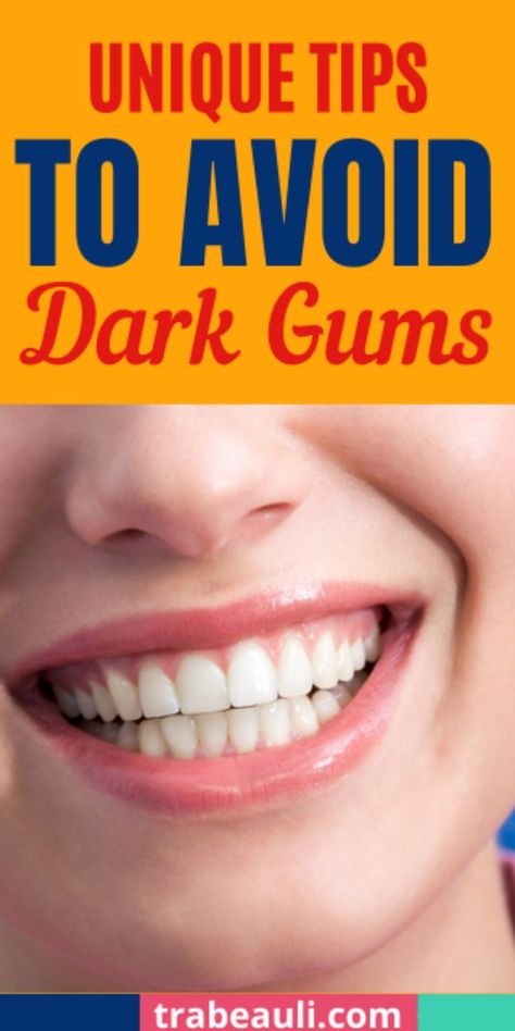 dark gums Dark Gums, Healthy Gums, Black Gums, Healthy Lifestyle Tips, Tooth Decay, Healthy Teeth, Oral Health, Oral Care, Cavities