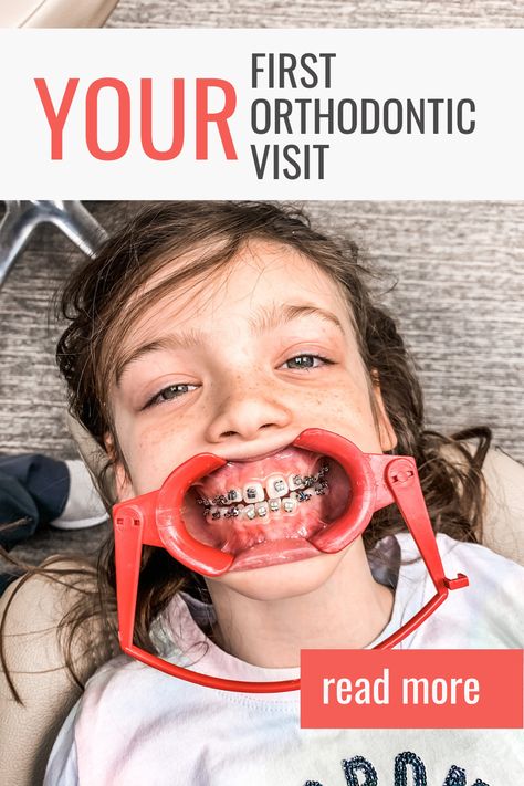 First Time Braces, Braces Colors Ideas, Jewelry Teeth, Braces Pain, Teeth Gems, Health History Form, Braces Cost, Braces Tips, Getting Braces