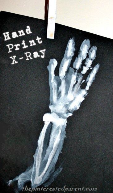 Hand print X-ray Preschool Xray Craft, Human Body Projects, Xray Art, Body Craft, Daycare Providers, Group Ideas, Alphabet Crafts, Abc Book, Preschool Letters