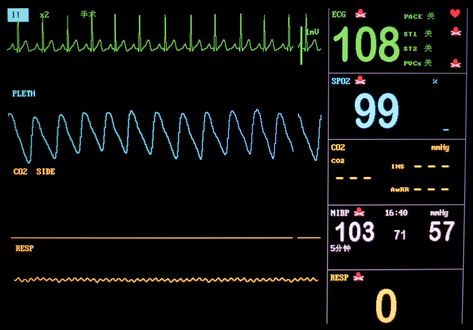 Why you can't shock out of asystole. Flat Line Heartbeat Monitor, Flat Line Heartbeat, Heartbeat Monitor, Fire Medic, Heartbeat Line, Watching Television, Heart Monitor, In A Heartbeat, Drain