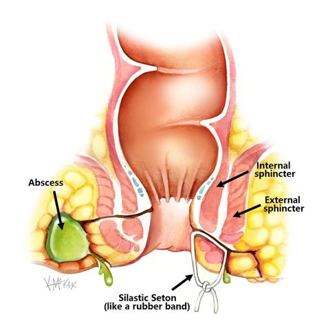 Fistula Surgery, Anatomy Pictures, Nurse Skills, Community Nursing, Human Body Anatomy, Medicine Journal, Large Intestine, Body Anatomy, Medicinal Plants