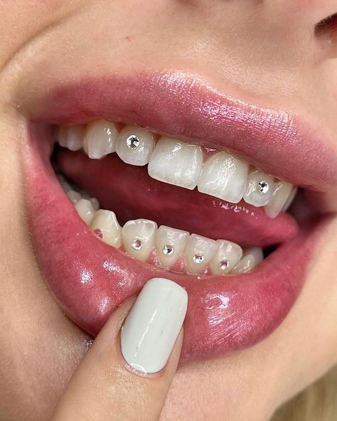 Tooth Gems Bottom Teeth, Tooth Gem Placement, Prom Prep, Pretty Teeth, Dental Jewelry, Tooth Jewelry, Grillz Teeth, Teeth Caps, Dental Aesthetics