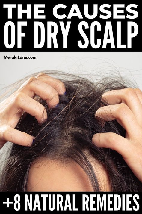 The best dry scalp DIY treatments. Dry scalp treatments that you could do at home. Healthy hair starts with a healthy scalp. You could also use these dry scalp treatments for itchy scalps. Scalp detox for hair growth and scalp detox for buildup. The best self care habits. Click for the dry scalp treatments. #scalptreatment #scalpdiy #scalpdetox #beautyhacks #diydryscalptreatment #selfcarechecklist #haircare #dryhair Remedies For Itchy Scalp, Itchy Scalp Remedy, Coconut Oil Hair Mask Diy, Dry Flaky Scalp, Home Remedies For Dandruff, Scalp Mask, Scalp Problems, Dandruff Remedy, Diy Coconut Oil