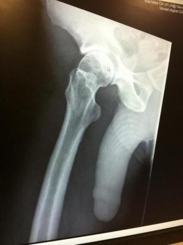 Do you see a fracture? Xray Humor, I Will Be Ok, Ill Be Ok, Scott Hall, Funny Facebook Status, Instagram Words, Vision Eye, Fun Photos, Broken Leg