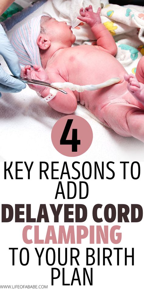 Benefits Of Delayed Cord Clamping, Birth Plan Examples, Natural Birth Plan, Natural Birth Tips, Birthing Plan, Birth Positions, Delayed Cord Clamping, Birth Hospital, Birth Plans