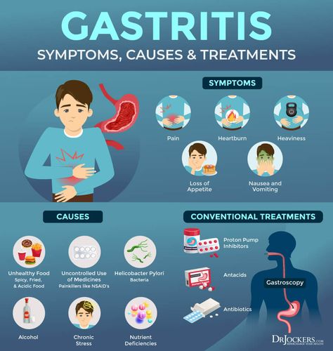 Gastritis: Symptoms, Causes, and Support Strategies - DrJockers.com Ulcer Symptoms, Gastric Problem, Reflux Diet, Gastrointestinal Disease, Acid Reflux Diet, Stomach Ulcers, Stomach Issues, Sensitive Stomach, Stomach Pain