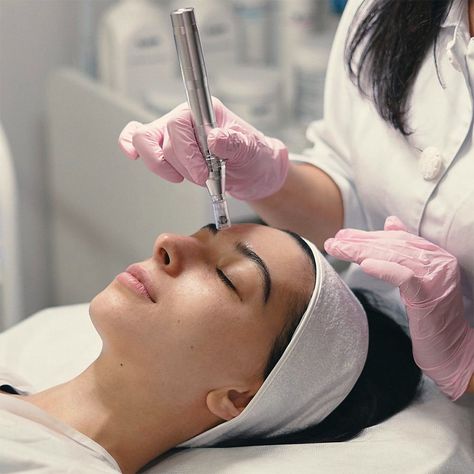 Is Microneedling Safe? Most Common Risks And Benefits Dermapen Microneedling, Facial Therapy, Facial Aesthetics, Aesthetic Clinic, Skin Care Clinic, Glow Skin, Beauty Therapy, Flawless Beauty, Skin Clinic