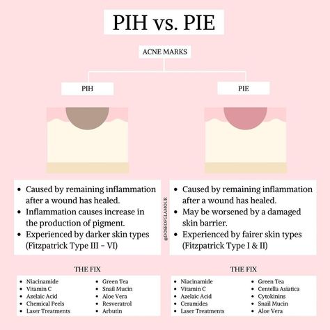 Do you know the difference between Post-Inflammatory Hyperpigmentation (PIH) and Post-Inflammatory Erythema (PIE)? Knowing the difference… Post Inflammatory Erythema, Red Acne Marks, Skincare Science, Glowing Skin Routine, Post Inflammatory Hyperpigmentation, Bad Acne, Mary Kay Skin Care, Face Care Routine, Sephora Skin Care