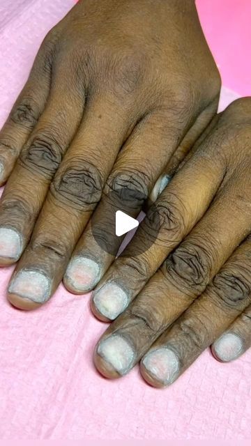 Dark Fingers Remedy, Hand Cleaning At Home, Face Home Remedies Skincare, How To Get Fair Hands, How To Get Rid Of Finger Wrinkles, How To Get Rid Of Hand Wrinkles, How To Get Rid Of Wrinkles On Hands, How To Get Rid Of Dark Knuckles On Hands, Dark Knuckles Remedies