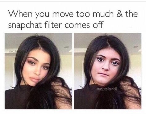 Lol: Kylie Jenner after and before plastic surgery. Fresh Memes, Snapchat Filters, Home Alone, Really Funny Memes, Funny Laugh, Bones Funny, Plastic Surgery, Funny Posts, Really Funny