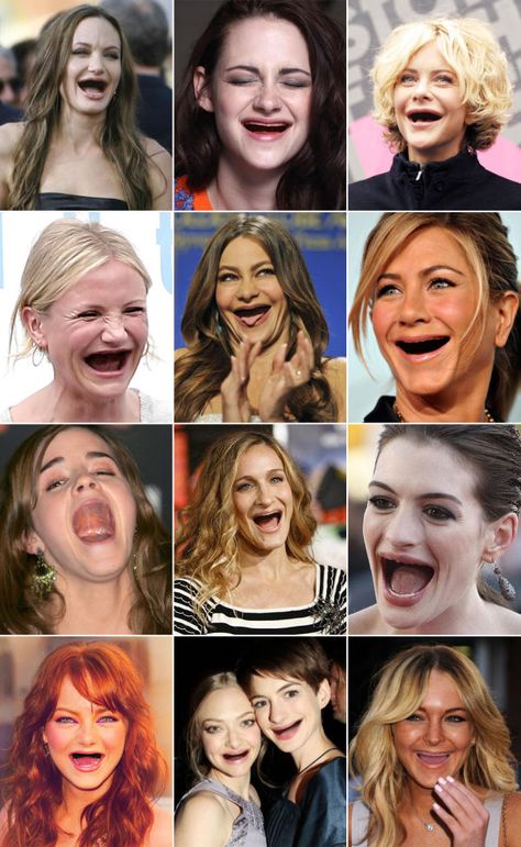 Popular actresses without teeth. I have no idea why this just creeped me out and made me laugh at the same time Dental Fun, Best Teeth Whitening, Dental Humor, Popular Actresses, Makijaż Smokey Eye, Funny Fails, Oral Health, Bones Funny, Make Me Smile