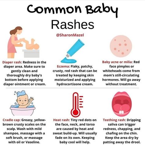 A little baby's skin is rarely picture perfect and blemish free. Here are just some of the many common rashes that may creep up in your baby's first year. Baby Rash On Face, Baby Heat Rash, Teething Rash, Baby Rashes, Baby Skin Rash, Rash On Face, Study Inspiration Quotes, Red Rash, Baby Acne