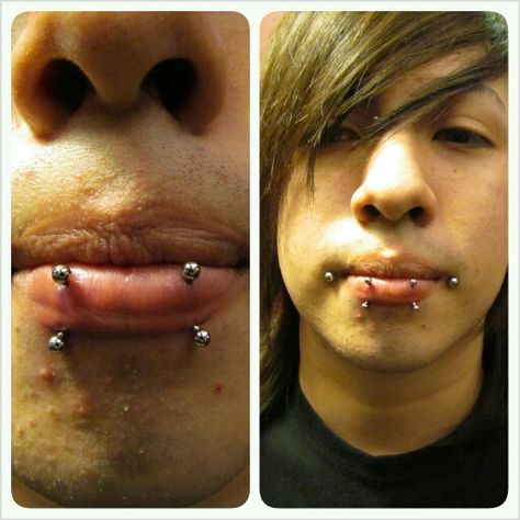 Double Vertical Labret Piercing, Double Labret Piercing, Double Vertical Labret, Alt Piercings, Middle Lip Piercing, Vertical Labret Piercing, Vertical Labret, Piercing Inspo, Face Piercings