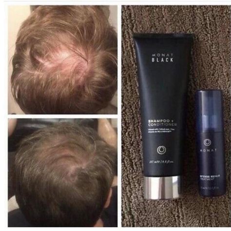 After 1 month using Black Shampoo from Monat.  Message me if you’re interested. Monat Black Shampoo, Aging Hair Care, Monat Before And After, Monat Black, Thicker Healthier Hair, Black Shampoo, Anti Aging Hair, Mens Hair Care, Monat Hair