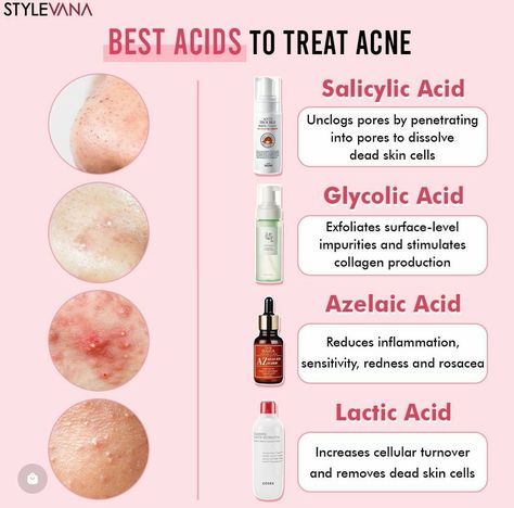 Get Rid Of Pimples, Rid Of Pimples, Haut Routine, Skin Facts, Skin Care Basics, Skin Advice, Skin Care Routine Order, Clear Healthy Skin, Treat Acne