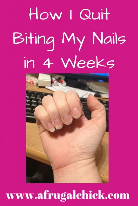 Nails Biting, Nail Biting Remedies, Nail Chewing, Bitten Nails, Nail Biting Habit, Biting Nails, Psychology Professor, Nail Remedies, Nails Care