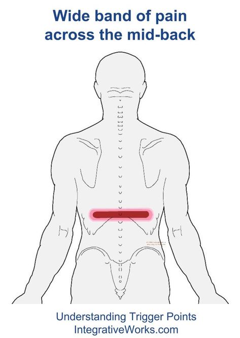 Trigger Points – Back Pain Across the Lower RibsIntegrative Works | Integrative Works Neuromuscular Therapy, Rib Pain, Mid Back Pain, Middle Back Pain, Low Back Stretches, Back Stretches For Pain, Frozen Shoulder, Back Pain Remedies, Massage Benefits