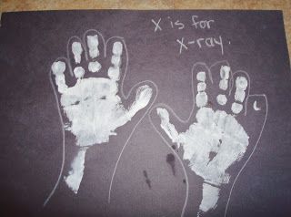 Reformed Ragamuffin: Kids: X is for X-ray (Doctor theme) Doctor Infant Crafts, Doctor And Nurses Activities Eyfs, Doctors And Nurses Preschool, Doctor Craft For Preschool, Qtip Crafts For Kids, Emergency Services Activities For Kids, Emergency Services Eyfs Activities, Doctor Crafts For Toddlers, Doctor Activities For Toddlers