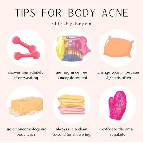 Tips For Back Acne, Body Acne Tips, Body Acne Routine, Acne Location Meaning, How To Get Rid Of Body Acne, Body Acne Products, Body Acne Remedies, 2024 Tips, Skincare Education