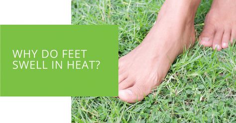 Learn about the causes and prevention of swollen feet in hot weather, including tips on reducing swelling and when to seek medical attention. Not Drinking Enough Water, Swollen Ankles, Sweaty Hands, Swollen Legs, Fluid Retention, Simple Health, Body Tissues, Healthy Liver, Good Mental Health