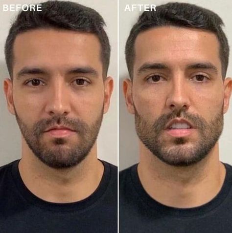 YOU CAN CHANGE THE SHAPE OF YOUR FACE Cheekbones Exercise, Jawline Men, Chiseled Jaw, Perfect Jawline, Good Jawline, Jaw Exercises, Jawline Exercise, Chiseled Jawline, Chin Exercises