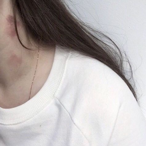 Hickies Neck, Fotografi Editorial, Ulzzang Couple, Photo Couple, Cute Relationship Goals, Couple Aesthetic, Girls In Love, Cute Couples Goals, استوديو الصور