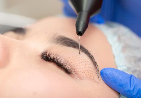 Botox Brow Lift, Drooping Eyelids, Permanente Make-up, Droopy Eyelids, Fractional Laser, Eyelid Lift, Upper Eyelid, Facial Rejuvenation, Brow Lift