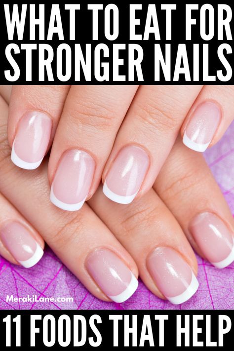 Nail Remedies, Nail Growth Tips, Grow Nails Faster, Nail Problems, Nail Vitamins, Weak Nails, Natural Detergent, Brown Spots On Face, Nail Care Tips