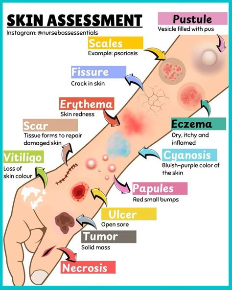 Skin Assessment #medschool #doctor #medicalstudent - Image Credits: Laura Guest Med Notes, Nurse Notes, Nursing School Essential, Basic Anatomy, Nurse Study, Medical Notes, Medical School Life, Nursing School Motivation, Nurse Study Notes