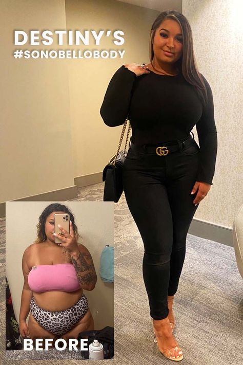 Destiny got laser liposuction and now has the body of her dreams. After her weight loss and fat loss journey, shes here to give women realistic body goals while also encouraging them to go after what they want. Her curves say it all! Lipo Before And After, Laser Lipo, Stubborn Fat, Dream Body, Body Image, Body Health, How To Feel Beautiful, Fat Loss, Destiny