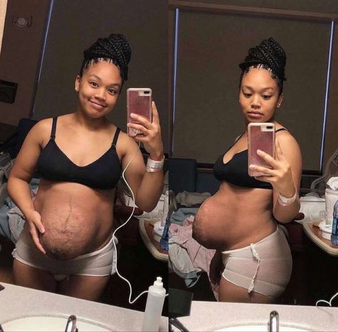 Reality of Childbirth 😱 ♥️ Follow instagram.com/drippykiids Senior Graduation Party, Pretty Pregnant, Birth Photography, Betty Cooper, Pregnant Belly, City Travel, Mothers Love, Fun Fact, Baby Fever