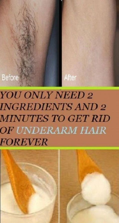 Best Permanent Hair Removal, Chin Hair Removal, Permanent Hair Removal Cream, Best Facial Hair Removal, Lip Hair Removal, Chin Hair, Unwanted Hair Permanently, Unwanted Hair Growth, Underarm Hair Removal