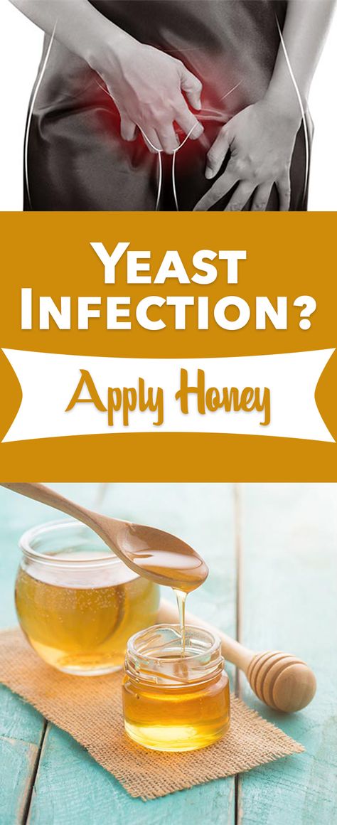 Yeast Infection Diet, Natural Lube, Candida Overgrowth, Unrefined Coconut Oil, Yeast Infections, Between The Sheets, Natural Alternatives, Healthy Bacteria, Health And Beauty Tips