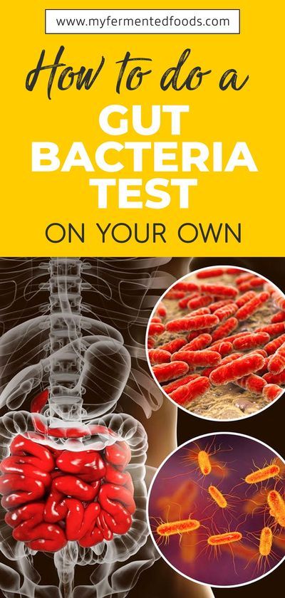 See how you can do a gut bacteria test at home on your own. It's very easy and quick. You just need to get a microbiome testing kit and take a sample. . . . #MyFermentedFoods #Fermentation #Fermenting #StayHealthy #GutBacteria #GutHealth #GutBacteriaTest #Microbiome #Gut #Health Gut Bacteria Cleanse, Gut Bacteria Food, Women Probiotics, Organization Sheets, Good For Gut Health, Cleanse Gut, Gut Supplements, Healthy Gut Diet, Microbiome Diet