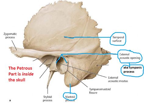 Temporal bone Temporal Bone Anatomy, Temporal Bone, Radiology Schools, Muscles Anatomy, Axial Skeleton, Bio Notes, Biology Diagrams, Anatomy Bones, Skull Anatomy