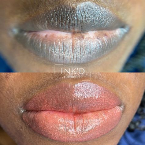 𝗠𝗜𝗔𝗠𝗜 𝗟𝗜𝗣 𝗕𝗟𝗨𝗦𝗛 - 𝗢𝗠𝗕𝗥𝗘 𝗕𝗥𝗢𝗪𝗦 - 𝗕𝗥𝗢𝗪 𝗟𝗔𝗠𝗜 | Lip neutralization is a game-changer for anyone who struggles with uneven lip color 😍 Achieve a flawless, natural-looking result with this … | Instagram Lip Neutralization, Ombre Brows, Lip Blush, Lip Filler, After Care, Lip Tattoos, Semi Permanent Tattoo, Dark Lips, Lip Fillers