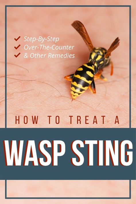 Essential Oil For Wasp Sting, Essential Oils For Wasp Stings, Essential Oil Wasp Sting, How To Treat A Wasp Sting, Hornet Sting Remedy, Wasp Sting Remedy Swelling, Red Wasp Sting, Wasp Stings Relief, Sting Young