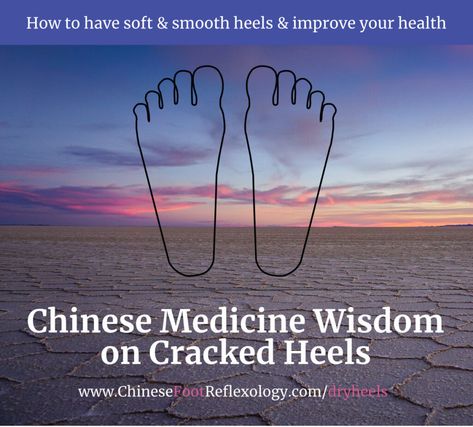 What Causes Cracked Heels, Reflexology Points, Dry Cracked Heels, Poor Circulation, Western Medicine, Bad Puns, Cracked Heels, Life Force Energy, Mind Body Connection