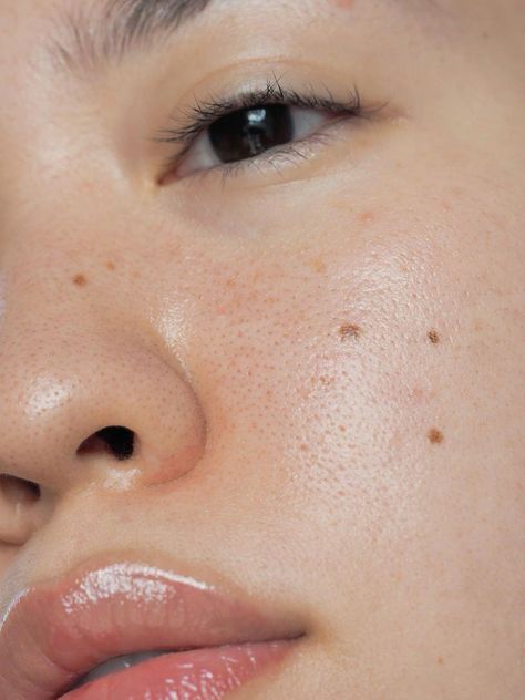 Skin Conditions Photography, Real Skin Photoshoot, Skin Zoomed In, Skin Close Up Texture, Skin Close Up, Skin Texture Photography, Imperfections Photography, Skin Up Close, Imperfection Photography