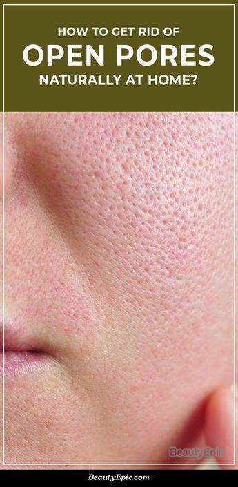 Minimize Pores Naturally, Big Pores, Face Pores, Beauty Hacks Skincare, Ootd Instagram, Open Pores, Smaller Pores, Natural Face Skin Care, Make Up Videos